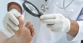 The doctor examines the leg affected by the mushroom