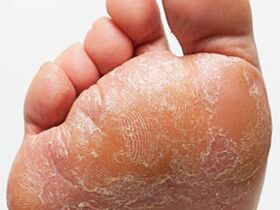 The foot mushroom
