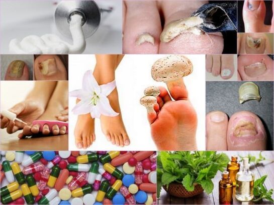 Popular remedies