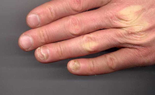 So by the hand